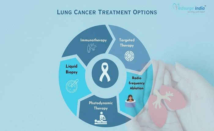 Innovative Lung Cancer Treatment Options